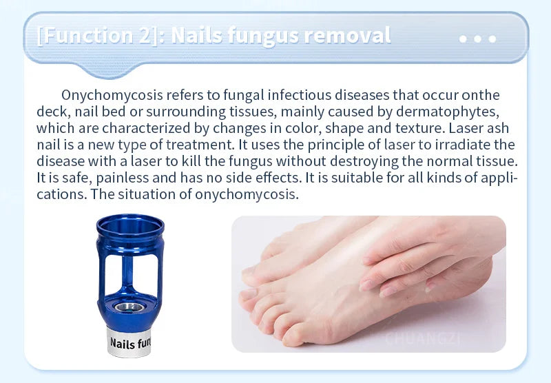 980nm diode laser nail fungus removal spider vein removal physical therapy and Lipolaser reduce cellulase