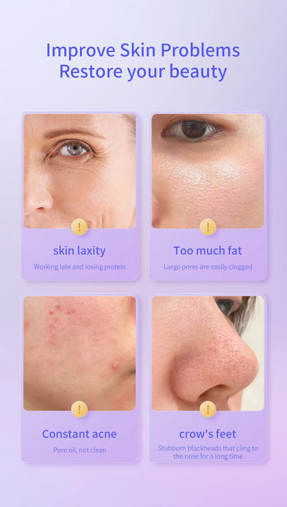 Skin Cool - Máquina de Beleza Facial Cryo-Eletroporação com Lifting e Circulação Linfática