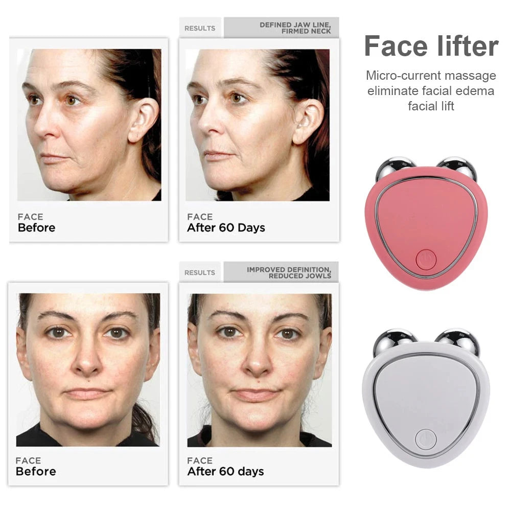 Máquina de Lifting Facial - Massageador Facial com Microcorrente e Rolo para Rejuvenescimento e Beleza