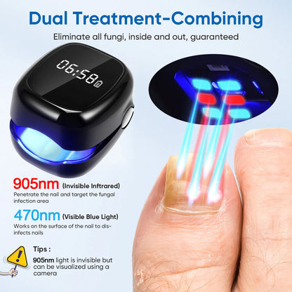Black Fungal Nail Laser Device Repair Nails Fungus Onychomycosis Nail Fungus Cleaning Laser Device Foot Nail Care Tools
