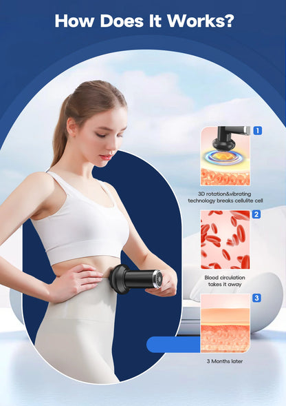 Máquina Body Sculpting Elétrica Anti-Celulite - 5 Cabeças Massagem Rotativa Corpo Inteiro Relaxamento