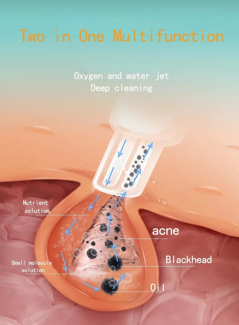 Máquina Hidra Peel Dermabrasão 3 em 1 - Limpeza Facial Hidrofaciais Beleza Hidrodermabrasão