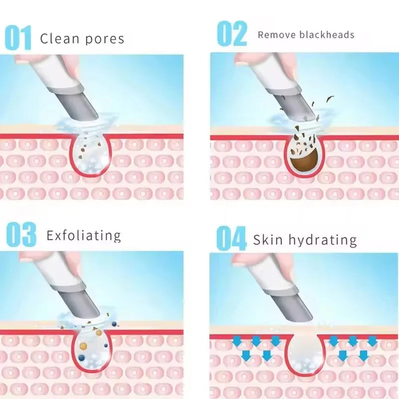 Máquina Hidra Peel Dermabrasão 3 em 1 - Limpeza Facial Hidrofaciais Beleza Hidrodermabrasão