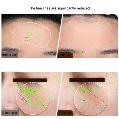 Dispositivo EMS Radiofrequência Corporal - Firmeza Facial e Corporal Anti-Envelhecimento