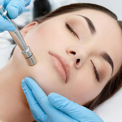 Máquina Microdermoabrasão Diamante Beauty Star - 65-68cmHg Uso Profissional e Doméstico