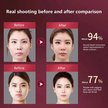 Dispositivo Lifting Facial LED Fototerapia - Massageador Vibracional Aquecido Papada Rosto V