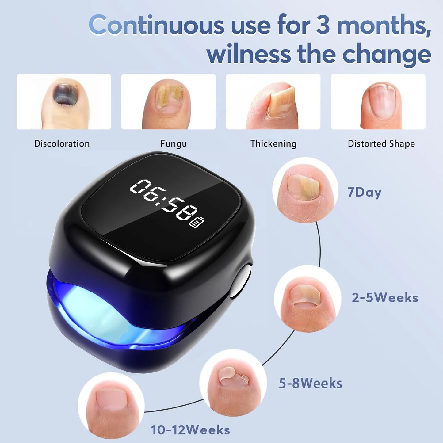 Black Fungal Nail Laser Device Repair Nails Fungus Onychomycosis Nail Fungus Cleaning Laser Device Foot Nail Care Tools