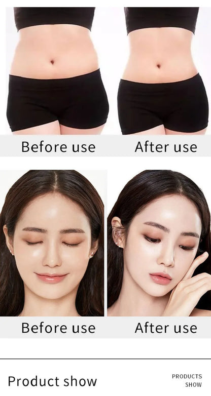 Máquina Estética 9 em 1 - Cavitação 40K Radiofrequência Vácuo Laser Emagrecimento Corporal