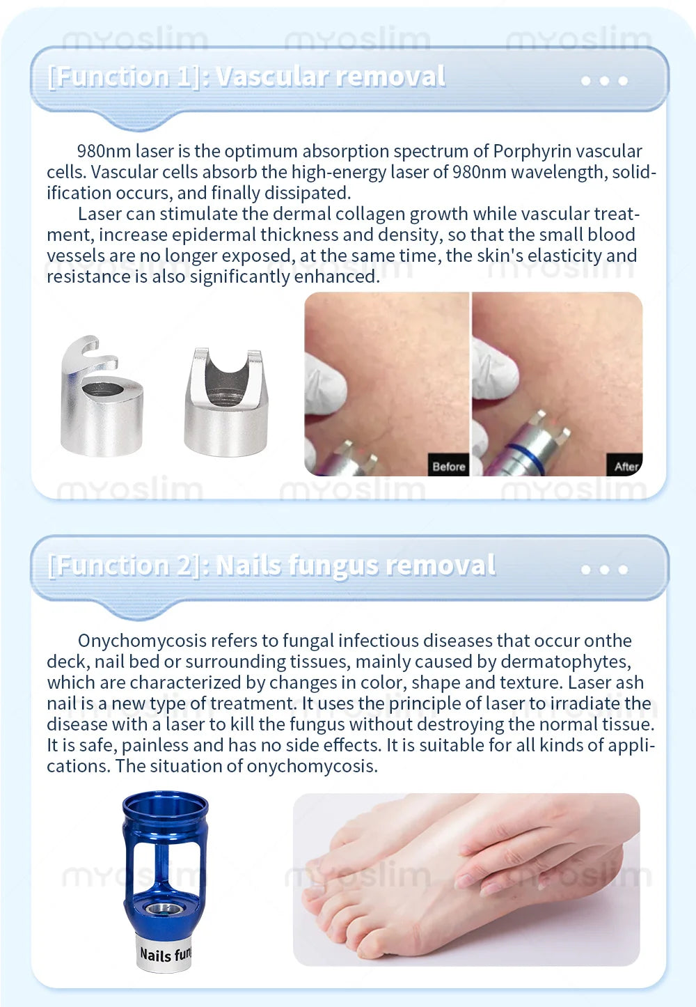 BEST 5 in 1 980nm Diode Laser Vascular Removal Machine Remove Spider Veins 980 Diode Laser Blood Vessels Removal Nail Fungus