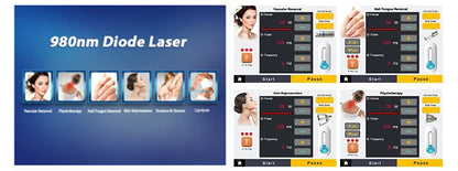980Nm Laser Diode Vascular Spider Varicose Vein Removal Machine Treatment Fungi Physiotherapy For Nail Lipolisi Commercial Salon