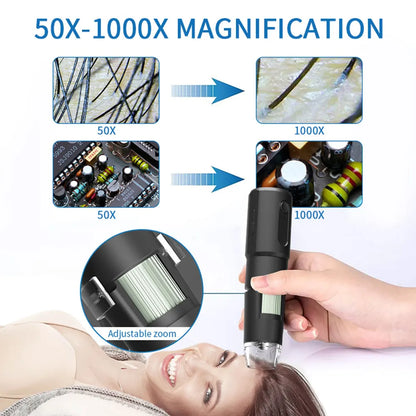 Dermatoscópio Wireless Analisador Pele Couro Cabeludo - Máquina Análise Facial Corporal Microscópio Eletrônico Profissional