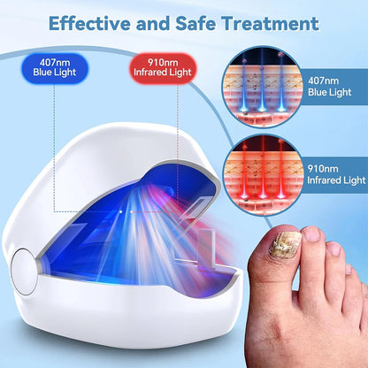 Nail Fungus Laser LED Light Device Fungal Nail Treatment Anti-Equipment Effectively Remove Fungal Toenail Nail Fungal Infection