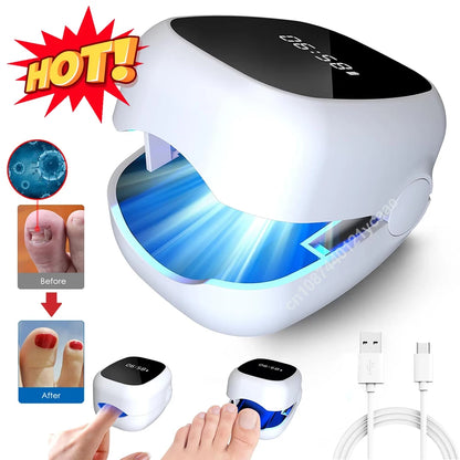 Nail Fungus Laser LED Light Device Fungal Nail Treatment Anti-Equipment Effectively Remove Fungal Toenail Nail Fungal Infection