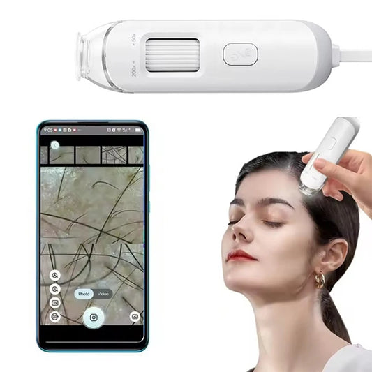 Dermatoscópio Eletrônico Câmera Couro Cabeludo - Analisador Pele Facial Profissional Microscópio Digital Ampliador Poros