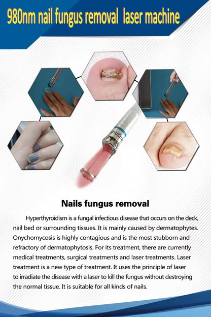 Newest 6 in 1 980nm Diode Laser Therapy Machine Vascular Removal Spider Vein Removal Machine Nail Fungus Laser Onychomycosis