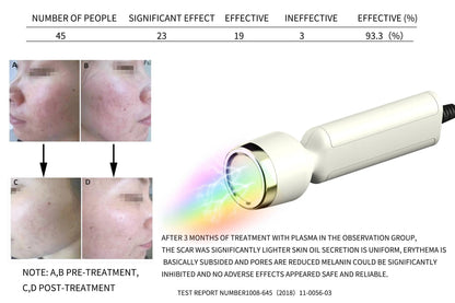 Máquina Hydra Facial Profissional RF Bio Lifting - Microdermoabrasão e Dermoabrasão Aquática
