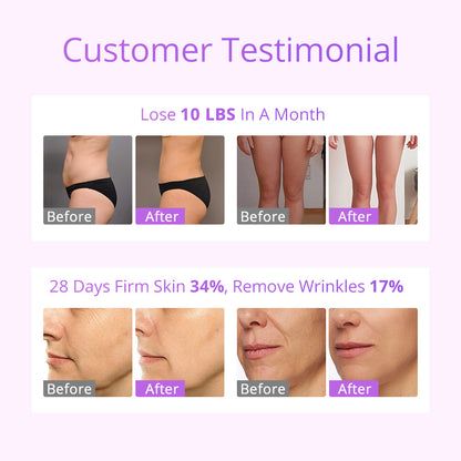 Máquina Cavitação Ultrassónica 5 em 1 - Laser Lipo 30K com Vácuo para Modelagem Corporal