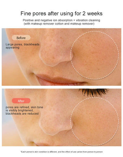 Novo Dispositivo RF Lifting e Firmeza Facial - Rejuvenescimento EMS Microcorrente Equipamento Beleza Doméstico