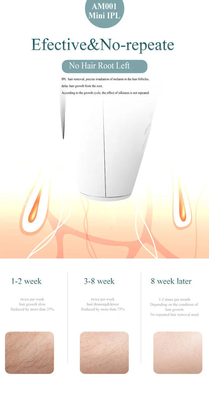 Depilador IPL Profissional Permanente - Remoção Pelos Corpo Inteiro Casa Mulheres 900.000 Flashes