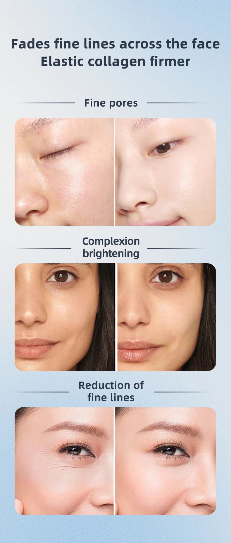 Massageador Facial EMS Aquecido com LED - Roller Rotativo Fototerapia Redução Poros Linhas Finas