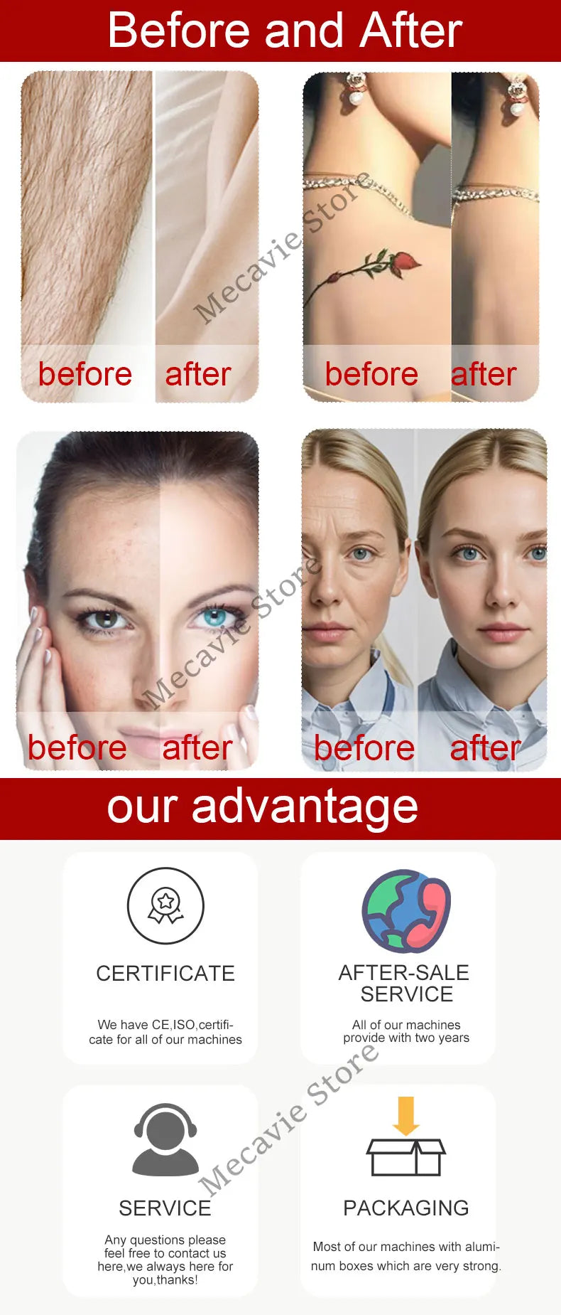 Máquina Laser 4 em 1 - Diodo Pico 808nm Peeling Carbono RF IPL Remoção Tatuagens