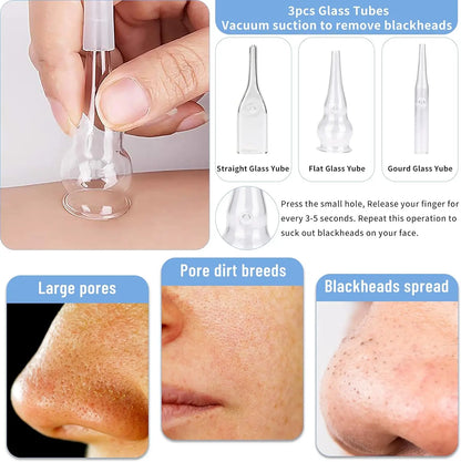 Máquina 3 em 1 Microdermoabrasão Diamante - Equipamento Profissional 65-68cmHg para Cuidados Faciais