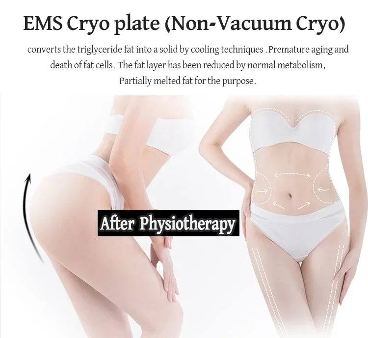 Máquina Criolipolise EMS com Estimulação Muscular - Equipamento Profissional Modelação Corporal