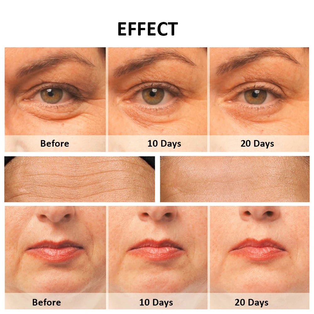 Massageador Facial Mesoterapia 8 em 1 - Radiofrequência EMS Lifting Firmeza LED Cuidados Pele