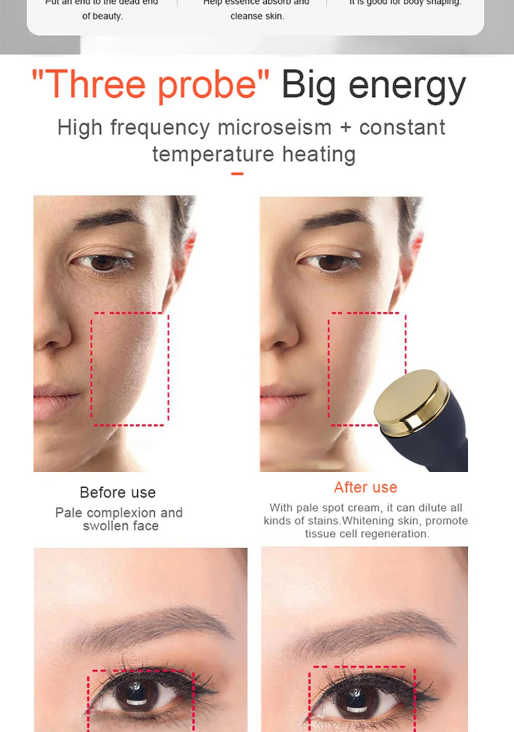 Máquina de Ultrassom 1 MHz para Casa - Terapia Facial e Corporal Anti-Envelhecimento 2024