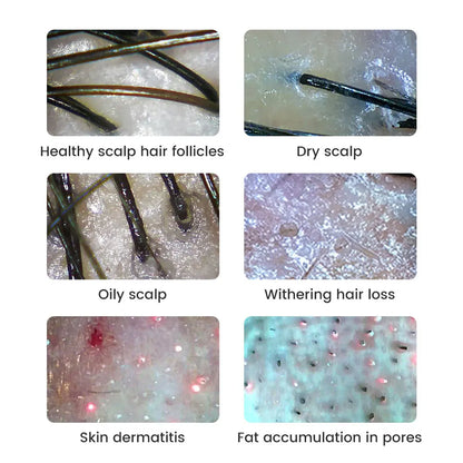 Dermatoscópio Wireless Analisador Pele Couro Cabeludo - Máquina Análise Facial Corporal Microscópio Eletrônico Profissional