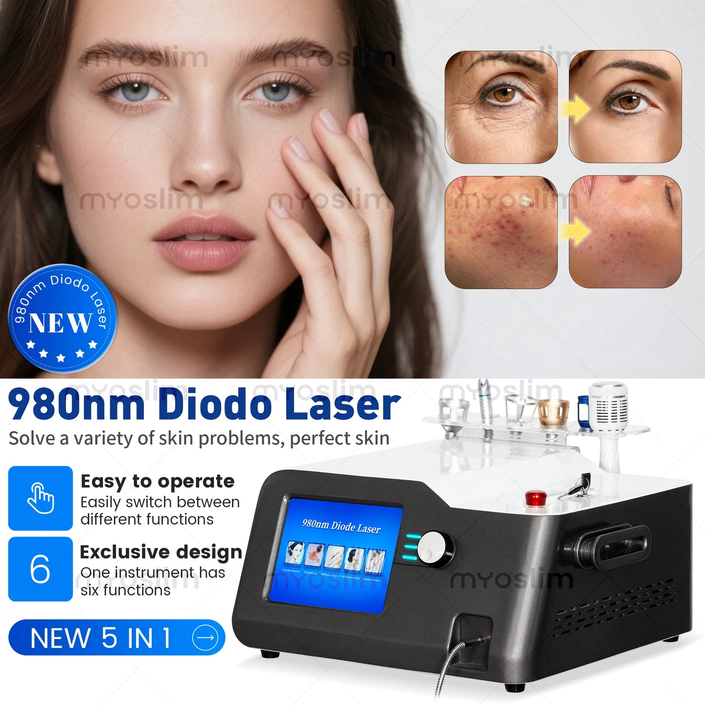 30W 5 in 1 980nm Diode Laser Blood Vessels Removal Nail Fungus 980 Diode Laser Vascular Removal Machine Remove Spider Veins